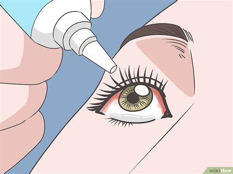 Safe and Effective Ways to Heal a Popped Blood Vessel in Your .